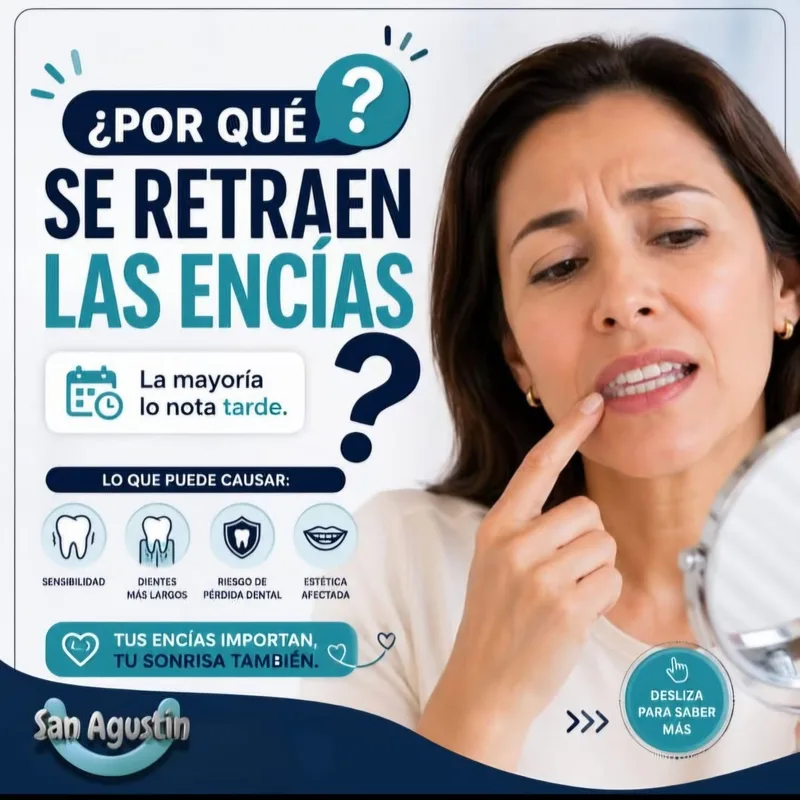 Post «¿Por qué se retraen las encías?»
